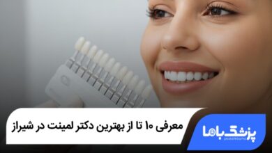 بهترین دکتر لمینت در شیراز