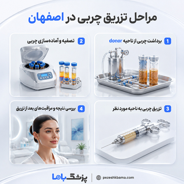 مراحل تزریق چربی در اصفهان