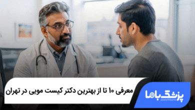 بهترین دکتر کیست مویی در تهران