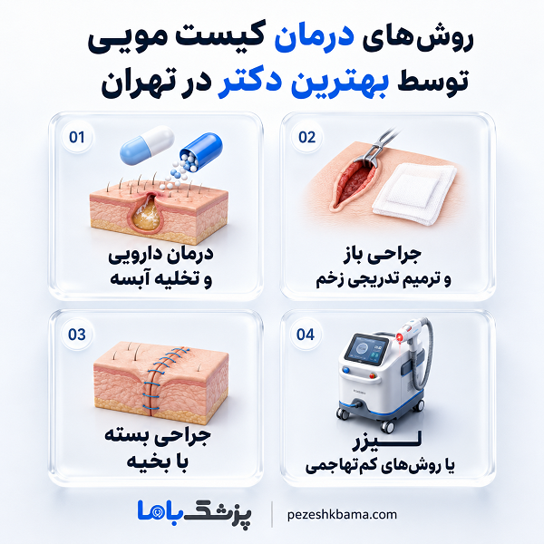 علائم کیست مویی که نباید نادیده گرفته شوند