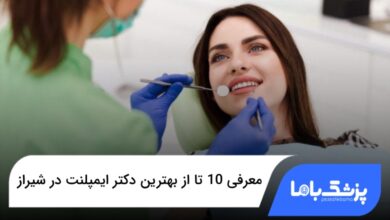بهترین دکتر ایمپلنت در شیراز