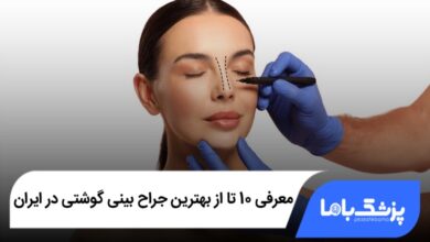 بهترین جراح بینی گوشتی در ایران