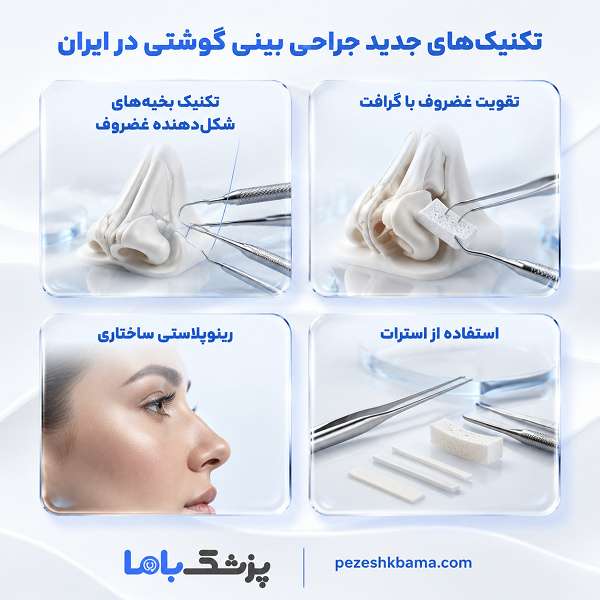 نکاتی که قبل از تصمیم به جراحی بینی گوشتی باید بدانید