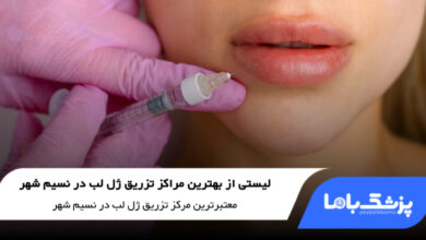 بهترین مرکز تزریق ژل لب در نسیم شهر