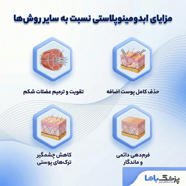 مزایای ابدومینوپلاستی نسبت به سایر روشها