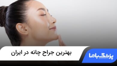 بهترین جراح چانه در ایران