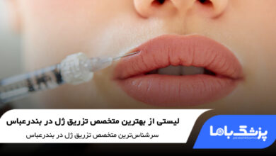 بهترین دکتر تزریق ژل در بندرعباس