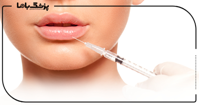 هزینه خدمات بهترین متخصص تزریق ژل در رباط کریم