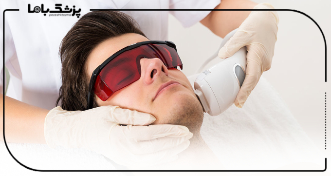 عوامل مؤثر بر نتیجه لیزر موهای زائد
