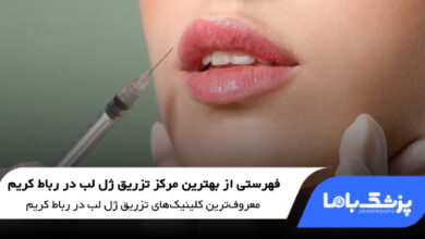 بهترین مرکز تزریق ژل لب در رباط کریم