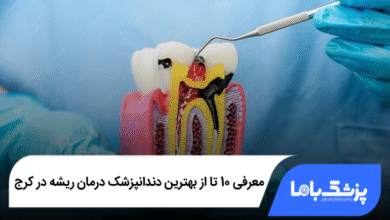 بهترین دندانپزشک درمان ریشه در کرج