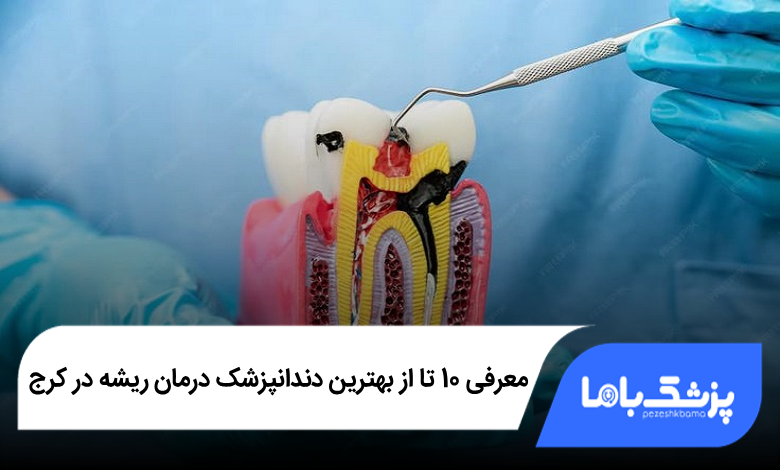 بهترین دندانپزشک درمان ریشه در کرج