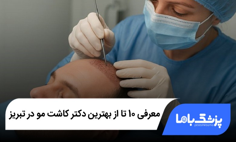 بهترین دکتر کاشت مو در تبریز