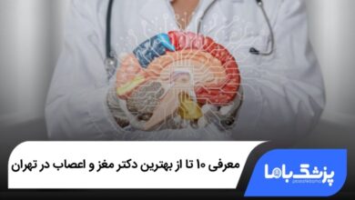 بهترین دکتر مغز و اعصاب در تهران