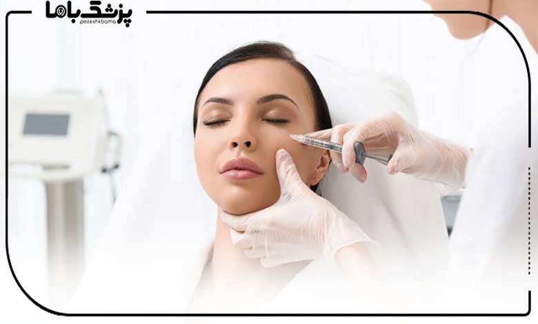 تزریق بوتاکس اطراف چشم توسط دکتر بوتاکس در اصفهان