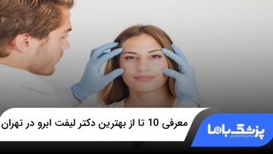 بهترین دکتر لیفت ابرو در تهران