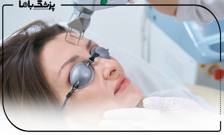 لیزر جوانسازی صورت در بهترین مرکز لیزر فرکشنال در تهران