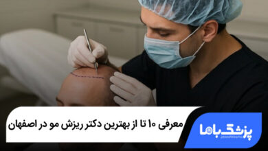 بهترین دکتر ریزش مو در اصفهان