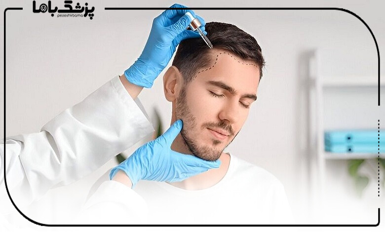 چه عواملی باعث ریزش مو میشود؟