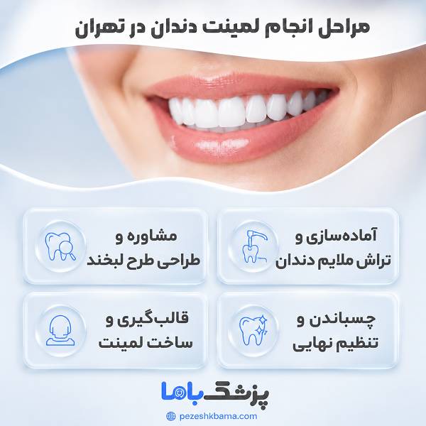 مراحل انجام لمینت دندان در تهران