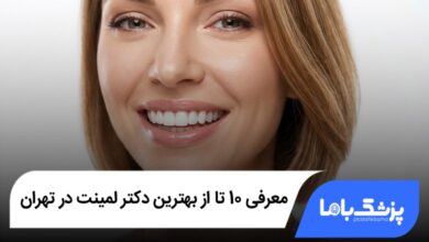 بهترین دکتر لمینت در تهران