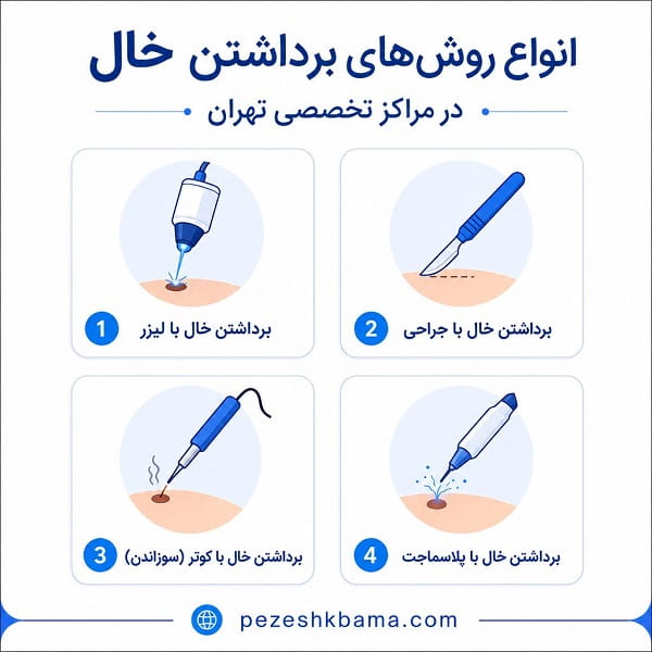 انواع روش های برداشتن خال در مراکز تخصصی تهران