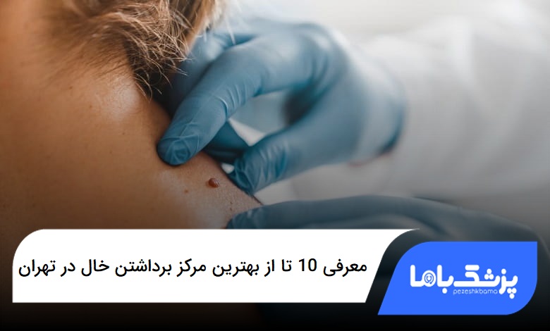بهترین مرکز برداشتن خال در تهران