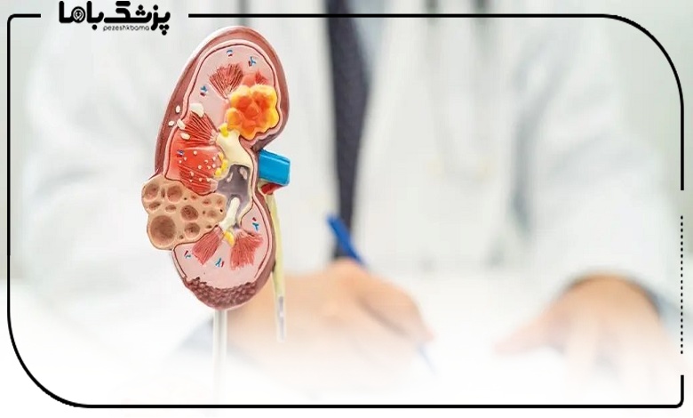 چگونه بهترین دکتر نفرولوژی در تهران را انتخاب کنیم؟