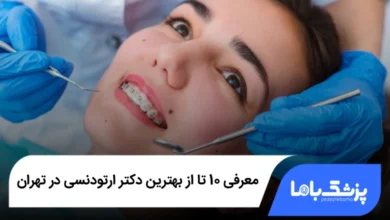 بهترین دکتر ارتودنسی در تهران