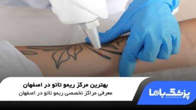 بهترین مرکز ریمو تاتو در اصفهان