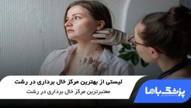 بهترین مرکز خال برداری در رشت