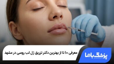 بهترین دکتر تزریق ژل لب روسی در مشهد