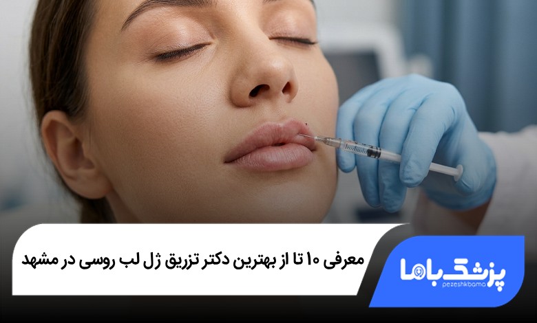 بهترین دکتر تزریق ژل لب روسی در مشهد