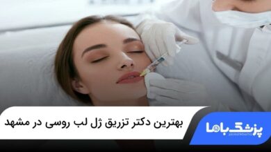 بهترین دکتر تزریق ژل لب روسی در مشهد
