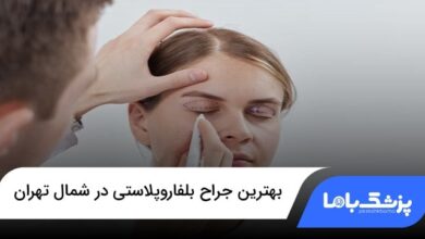 بهترین جراح بلفاروپلاستی در شمال تهران