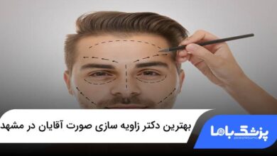 بهترین دکتر زاویه سازی صورت آقایان در مشهد