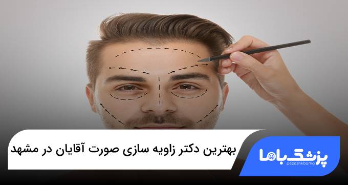 بهترین دکتر زاویه سازی صورت آقایان در مشهد