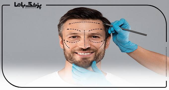 هزینه خدمات بهترین دکتر زاویه سازی صورت آقایان در مشهد