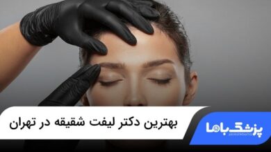 بهترین دکتر لیفت شقیقه در تهران