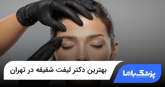 بهترین دکتر لیفت شقیقه در تهران