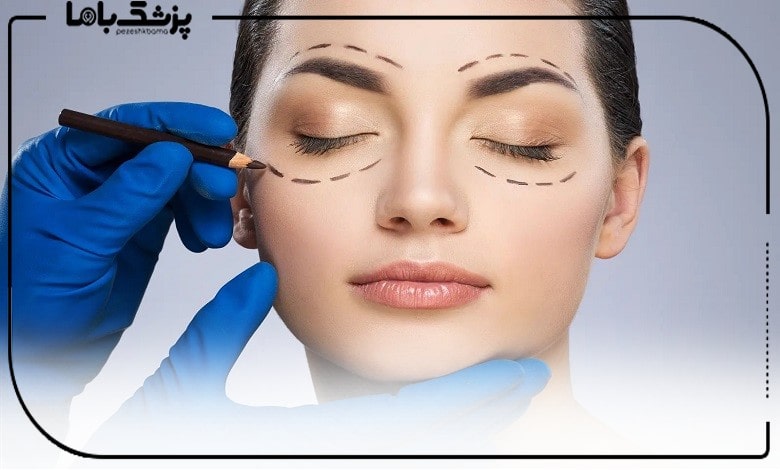 معیارهای انتخاب بهترین جراح بلفاروپلاستی در زعفرانیه