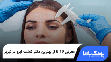 بهترین دکتر کاشت ابرو در تبریز