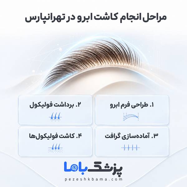 مراحل انجام کاشت ابرو در تهرانپارس