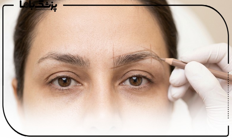 طراحی فرم ابرو توسط بهترین دکتر کاشت ابرو در تهرانپارس