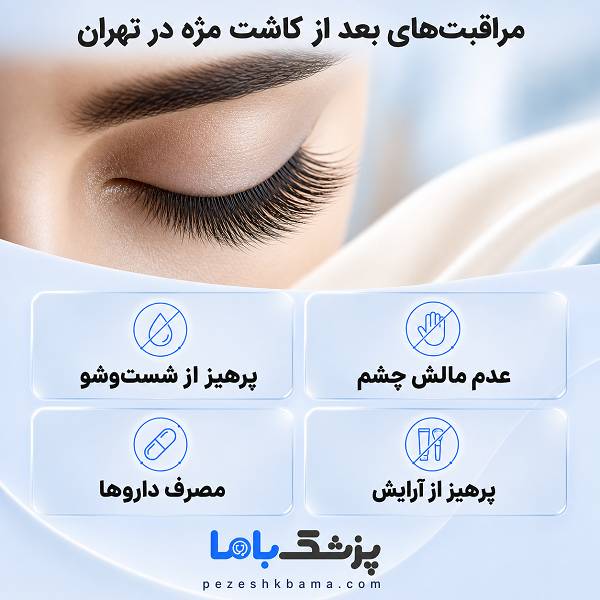 مراقبتهای بعد از کاشت مژه در تهران