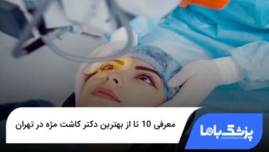 بهترین دکتر کاشت مژه در تهران