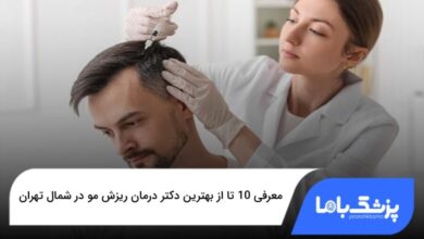 بهترین دکتر درمان ریزش مو در شمال تهران