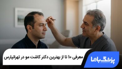 بهترین دکتر کاشت مو در تهرانپارس