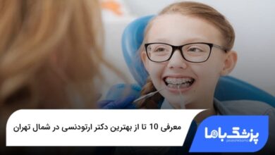بهترین دکتر ارتودنسی در شمال تهران