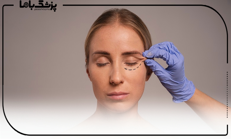 هزینه خدمات بهترین جراح بلفاروپلاستی در مشهد